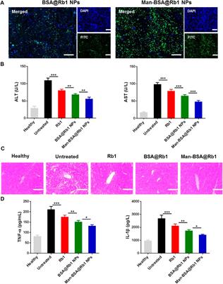 Mannose-decorated ginsenoside Rb1 albumin nanoparticles for targeted anti-inflammatory therapy